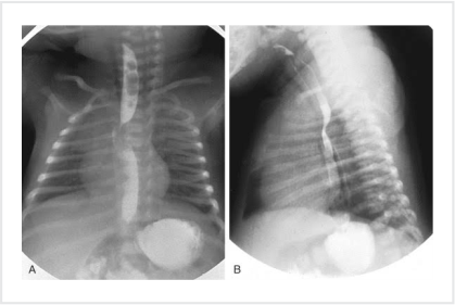 Barium Studies